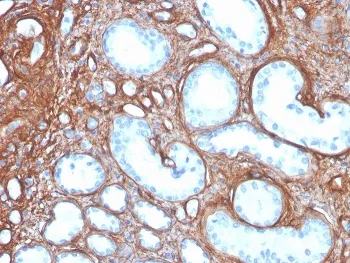 Collagen IV Recombinant Antibody / COL4A - image 1