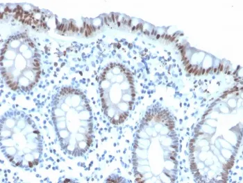 Histone H3 Recombinant Antibody (pSer10) - image 1