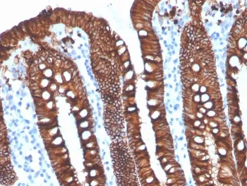EpCAM Recombinant Antibody - image 1