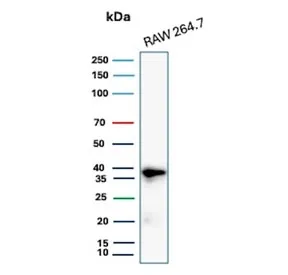 Cyclin D1 Recombinant Antibody / CCND1 - image 1