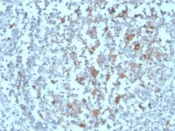 BAFF Receptor Antibody - image 1