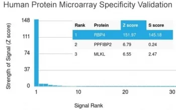 Retinol Binding Protein 4 Antibody / RBP4 - image 1