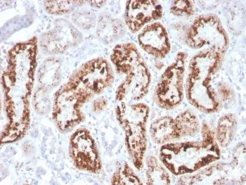 Retinol Binding Protein 4 Antibody / RBP4 - image 1