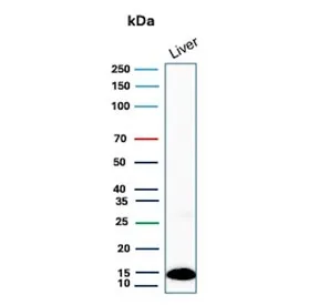 TTR Antibody / Transthyretin / Prealbumin - image 1