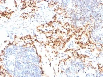 TIM-3 Antibody / HAVCR2 - image 1
