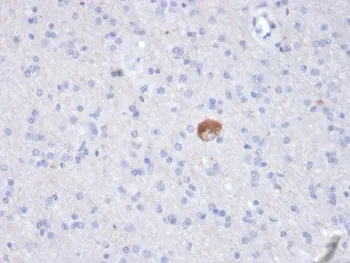 Amyloid beta Antibody / APP - image 1