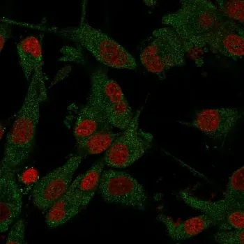 Amyloid beta Antibody / APP - image 1