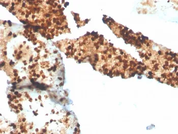 S100P Recombinant Antibody - image 1