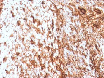 Vimentin Recombinant Antibody - image 1