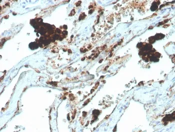 Napsin A Recombinant Antibody - image 1