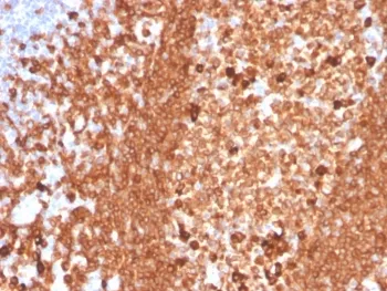 CD79a Recombinant Antibody - image 1