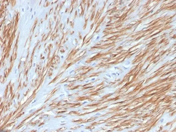 Calponin-1 Recombinant Antibody - image 1