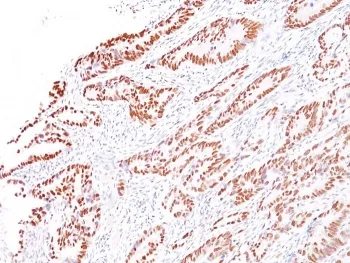 MLH1 Recombinant Antibody / MutL Homolog 1 - image 1