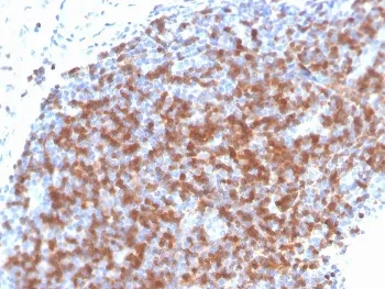 ZAP70 Recombinant Antibody - image 1
