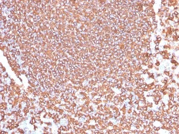 CD20 Recombinant Antibody / MS4A1 - image 1