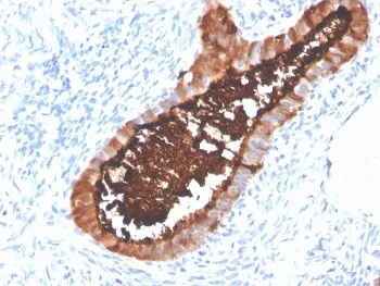 MUC16 Recombinant Antibody / CA125 - image 1