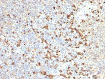TIM-3 Antibody / HAVCR2 - image 1