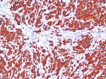 Pan Cytokeratin Antibody Cocktail (Acidic + Basic) - image 1