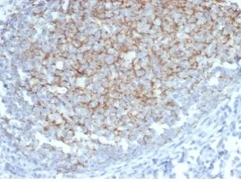 Interferon alpha 1 Antibody / IFNA1 - image 1