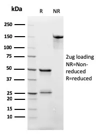 CD3 epsilon Recombinant Antibody - image 1