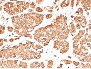 ACTH Recombinant Antibody / Synacthen - image 1