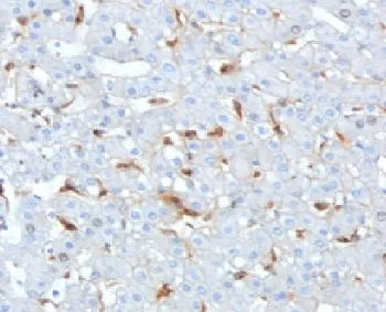 C1QB Antibody / Complement C1q B-Chain - image 1