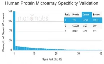 Tyrosinase Antibody / TYR - image 1