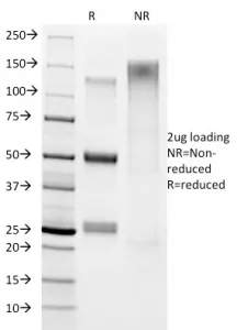 Helicobacter pylori Antibody - image 1