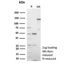Human Nuclear Antigen Recombinant Antibody - image 1
