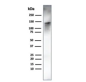 Caldesmon Recombinant Antibody / CALD1 / CAD (HMW) - image 1