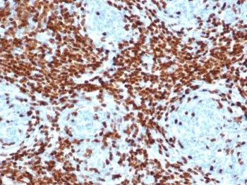 TdT Recombinant Antibody / DNA nucleotidylexotransferase - image 1