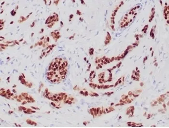 Progesterone Receptor Recombinant Antibody - image 1
