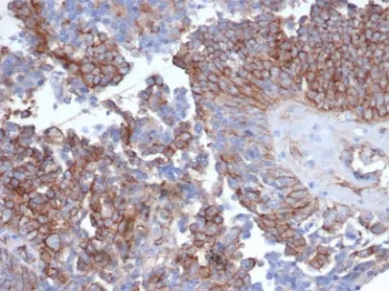 N-Cadherin Recombinant Antibody / CDH2 - image 1