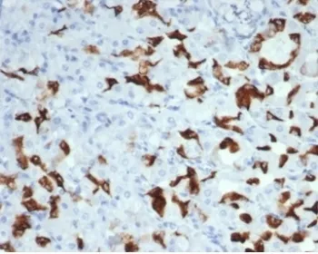 MUC6 Recombinant Antibody / Gastric Mucin - image 1