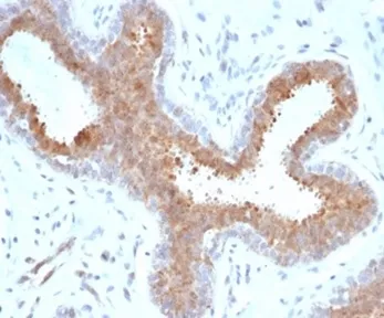 BAP1 Recombinant Antibody / BRCA1-Associated Protein 1 - image 1