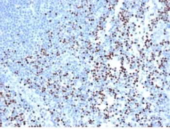 LEF1 Recombinant Antibody / Lymphoid enhancer-binding factor 1 / TCF1 alpha - image 1