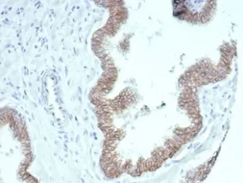 Beta Catenin Recombinant Antibody - image 1