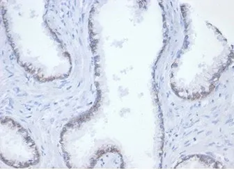 Beta Catenin Recombinant Antibody - image 1