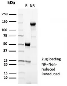 Perforin Recombinant Antibody / PRF1 - image 1