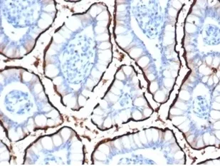 ACE2 Recombinant Antibody / Angiotensin-Converting Enzyme 2 - image 1