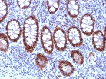PU.1 Antibody / SPI1 - image 1