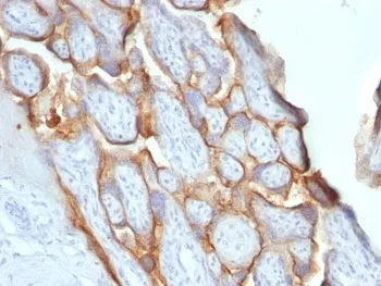 HCG-beta Antibody - image 1