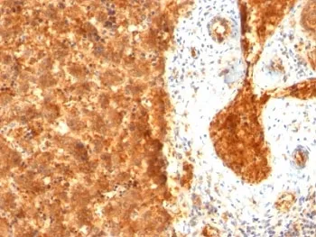 Alpha Fetoprotein / AFP Antibody - image 1