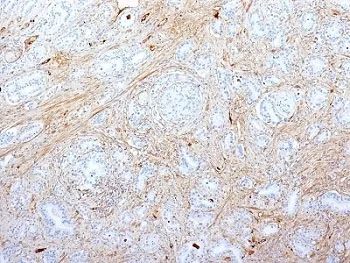 FN1 Antibody / Fibronectin - image 1