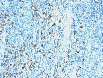 Lambda Light Chain Antibody / Lambda Antibody - image 1