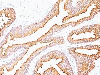 PSA / Prostate Specific Antigen Antibody - image 1
