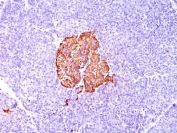 Insulin Antibody - image 1