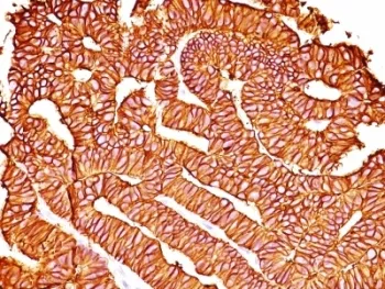 EpCAM Antibody - image 1
