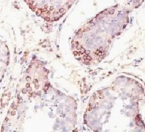 MAGE-1 Antibody - image 1
