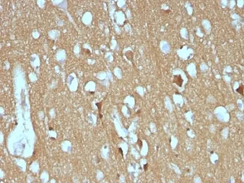NCAM / CD56 Antibody - image 1